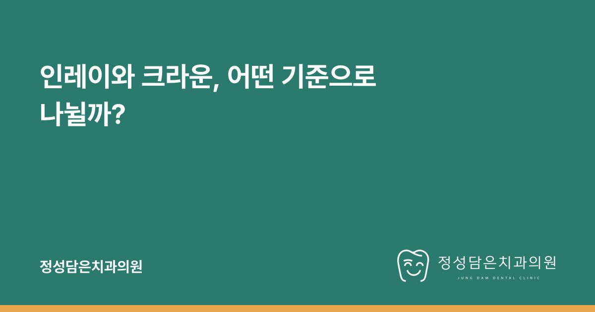 인레이와 크라운, 어떤 기준으로 나뉠까?