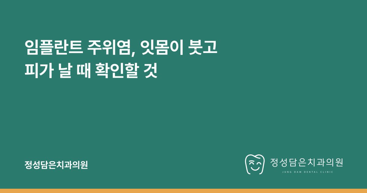 임플란트 주위염, 잇몸이 붓고 피가 날 때 확인할 것