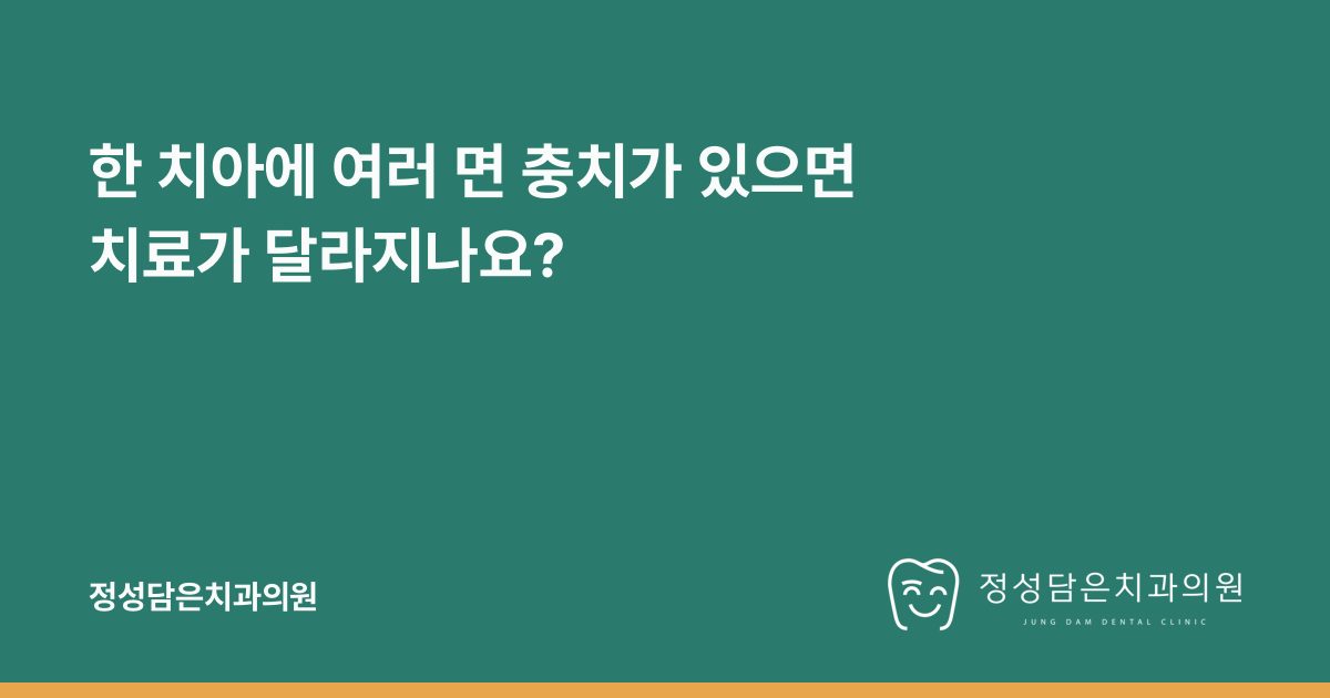 한 치아에 여러 면 충치가 있으면 치료가 달라지나요?