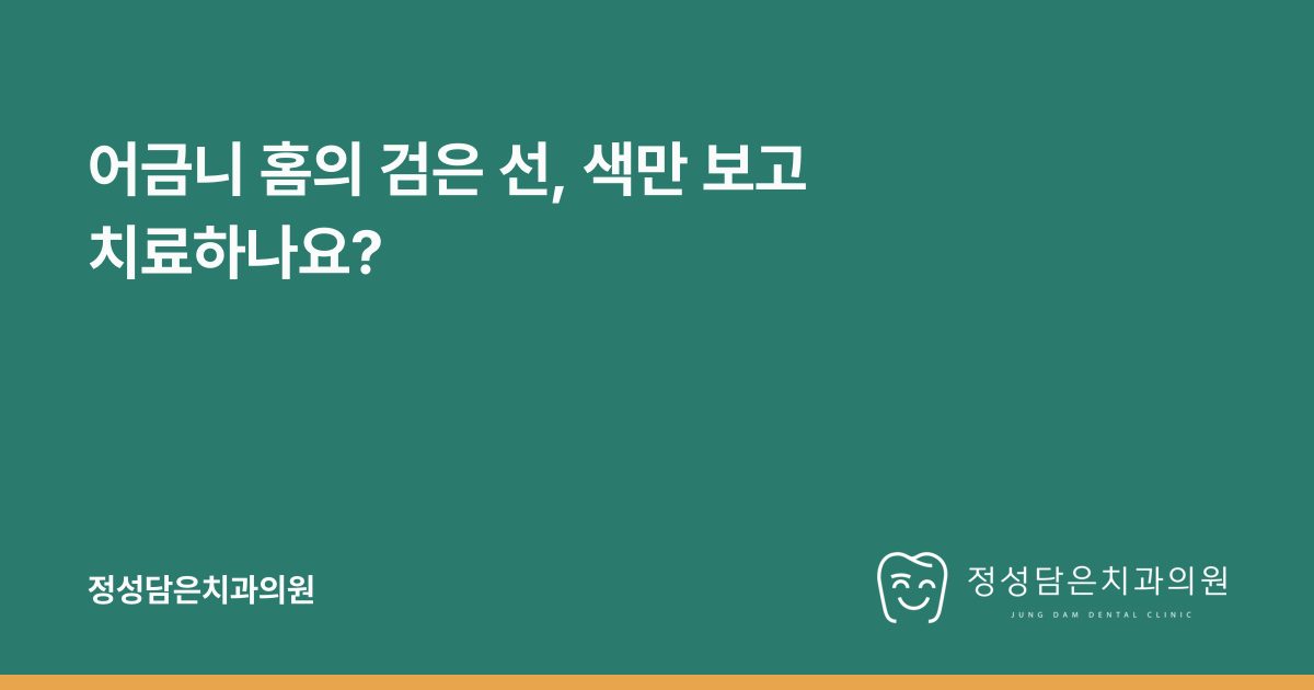 어금니 홈의 검은 선, 색만 보고 치료하나요?