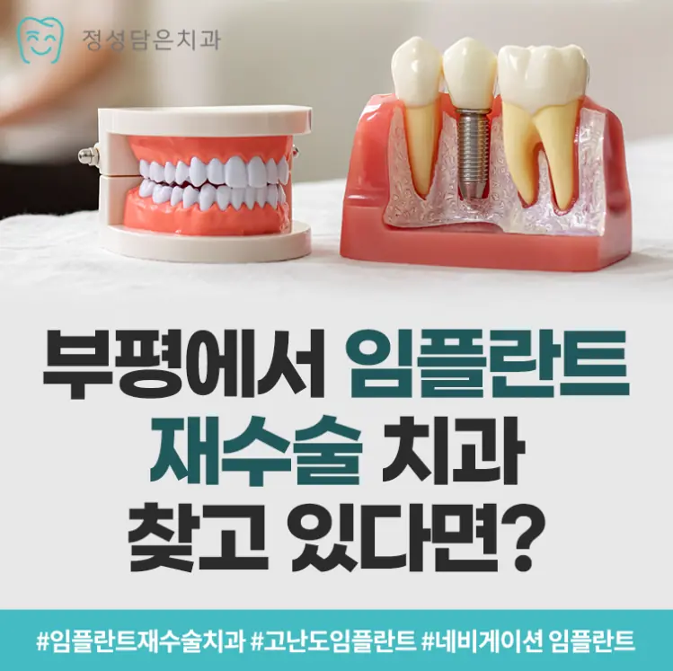 부평에서 임플란트 재수술 치과 찾고 있다면?