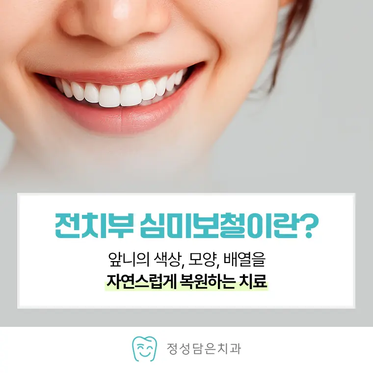 정성담은치과 전치부 심미보철이란?