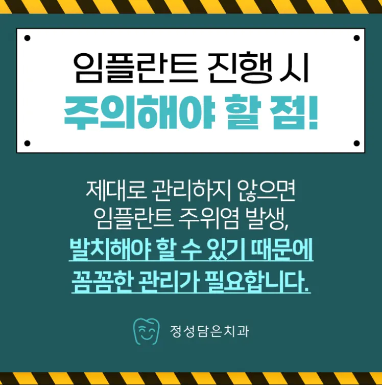 임플란트 진행 시 주의해야 할 점