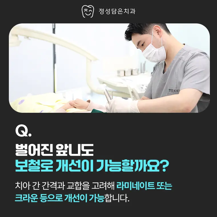 정성담은치과 벌어진 앞니도 보철로 개선이 가능할까요?