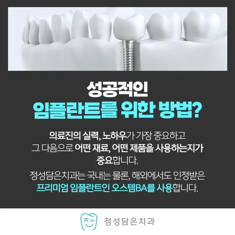 정성담은치과 성공적인 임플란트를 위한 방법