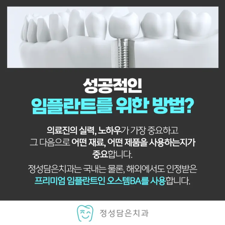 성공적인 임플란트를 위한 방법